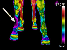 Nerve Damage
